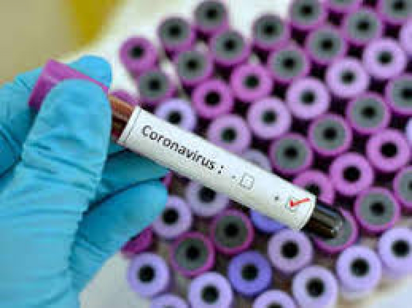 Confirman 113,600 casos coronavirus en el mundo